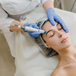 Micro needling